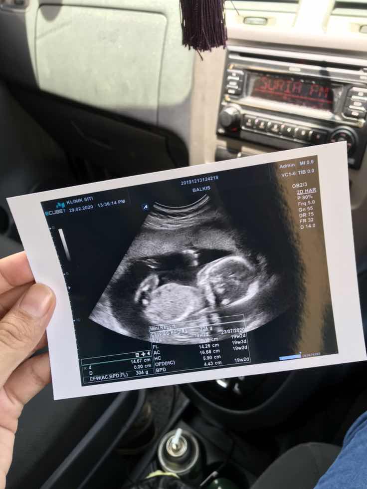 It's a...............