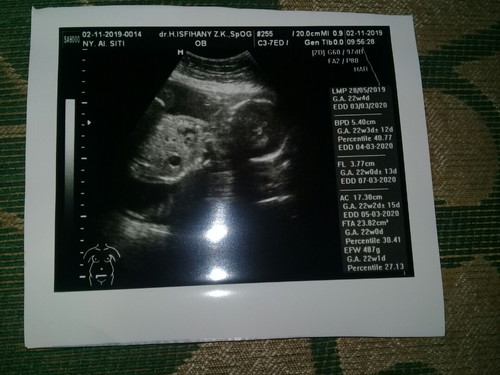 hasil usg 22 week