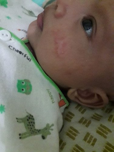 pipi merah