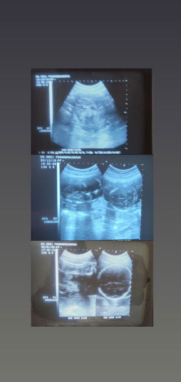 Dewi Oktaviani profile icon