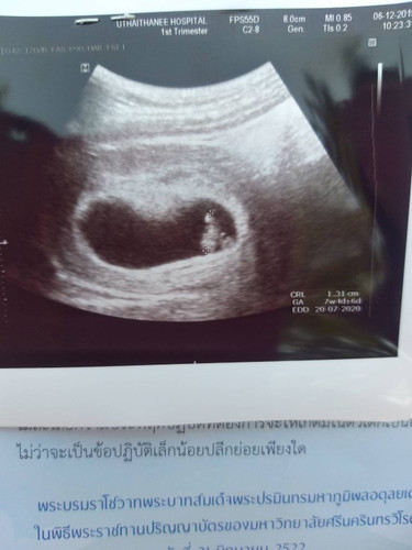 คลำไม่พบ