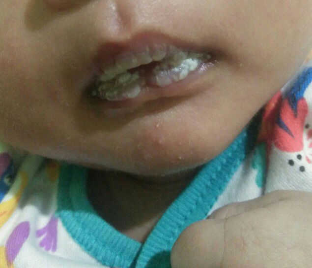 bibir bayi ku putih