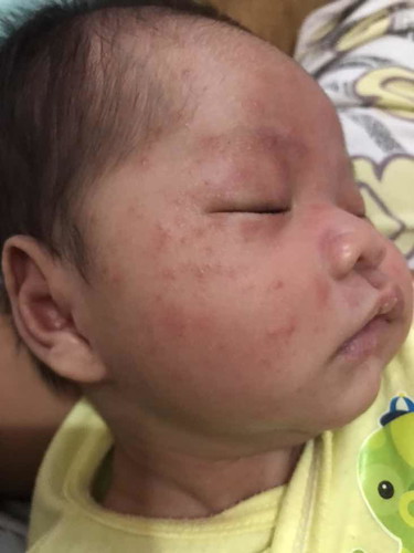 เปิดแอร์