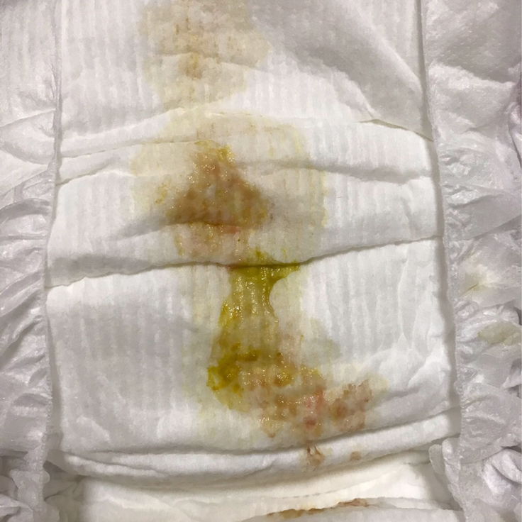 #ลูกถ่ายมีมูกปนเลือด