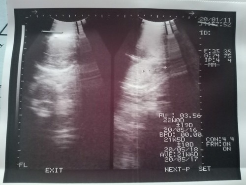 ดูใบซาวด์ไม่เป็นค่ะ