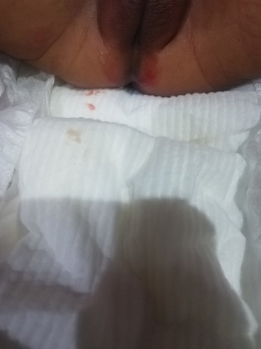 มีเลือดและมูกออกทางจิ๊มิ