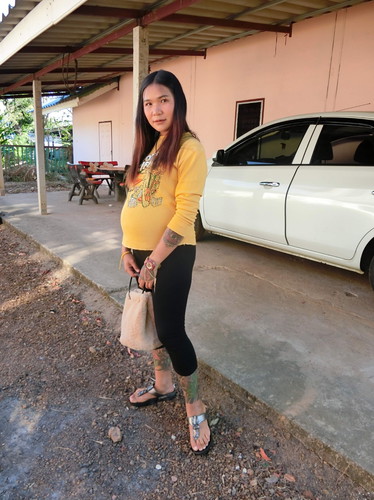 กำหนดคลอด