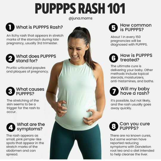 PUPPP Rash Pregnancy