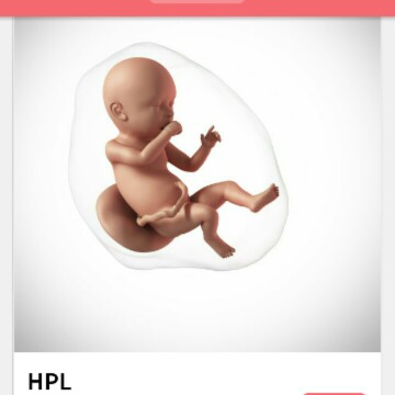 HPL