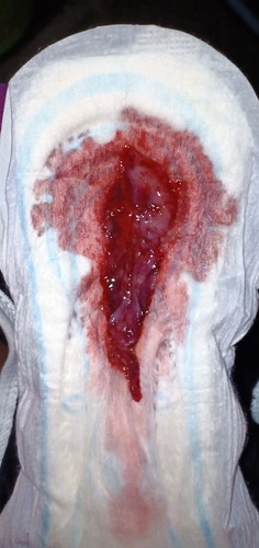 Menstruation after Birth