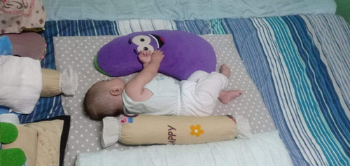 shape of my baby's head
