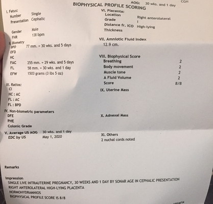 2 nuchal cords noted in UTZ