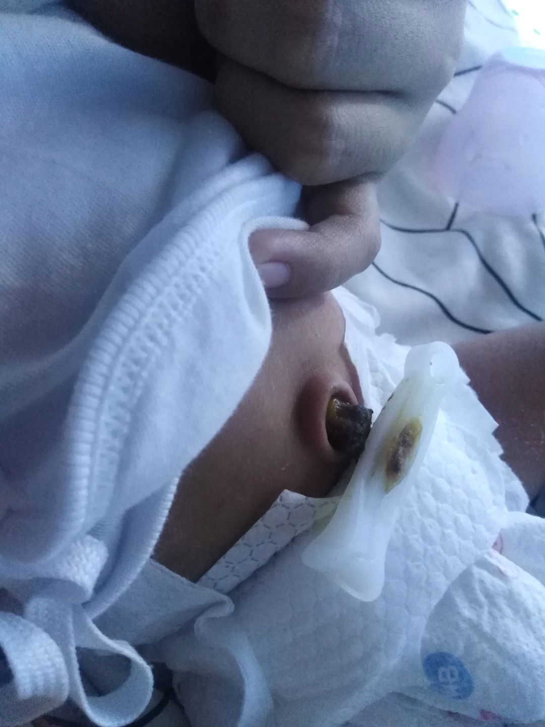 Mabahong Pusod Ni Baby