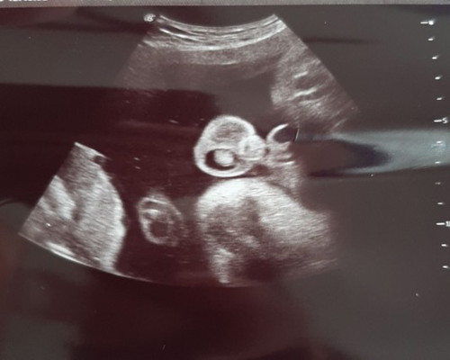 gender bby❤
