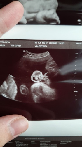 35 weeks pregnancy