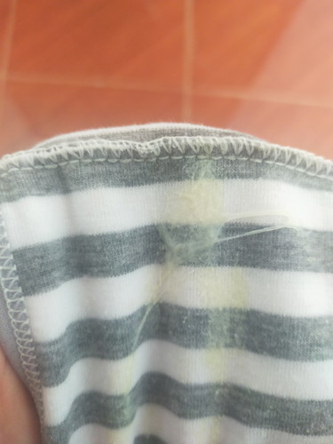 เรียกว่ามูกขาวหรือป่าวค่ะ