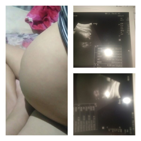 8เดือนจะ9เดือนแล้วยังไม่ทราบเพศลูกเลย