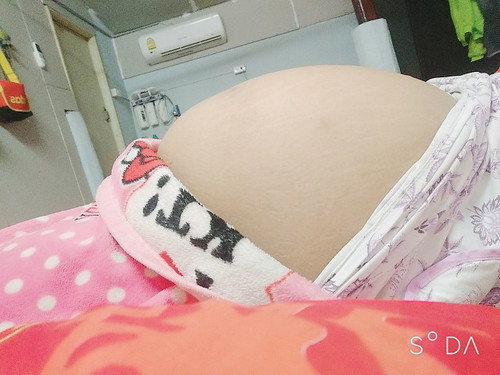 35 สัปดาห์