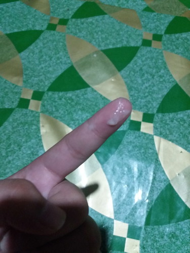 แบบนี้คืออะไรค่ะ