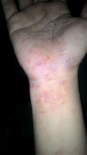 gatal panas MAAF jorok ya buun,,