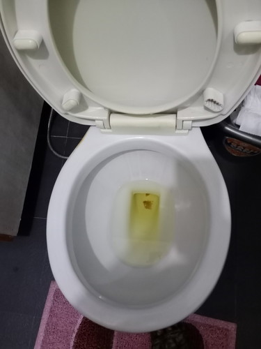 mucus plug