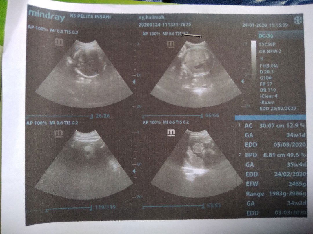 gk sabar nunggu 1 bln lagi