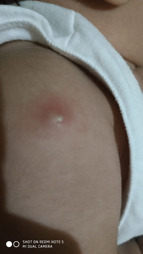 Vaccine