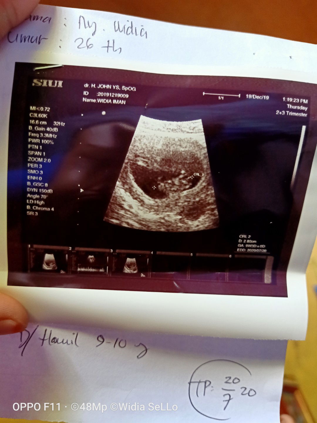 baru 2 bulan ud 2x usg