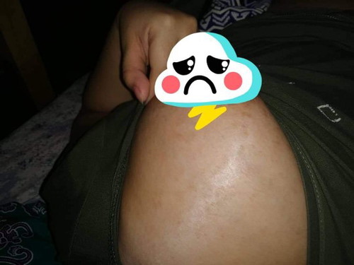 Itchy