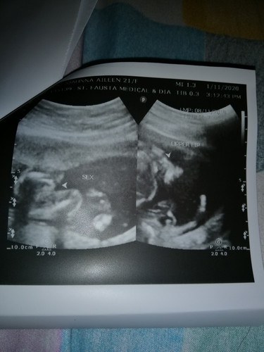 Ultrasound