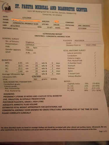 Kelan Talaga Ang Due Date?
