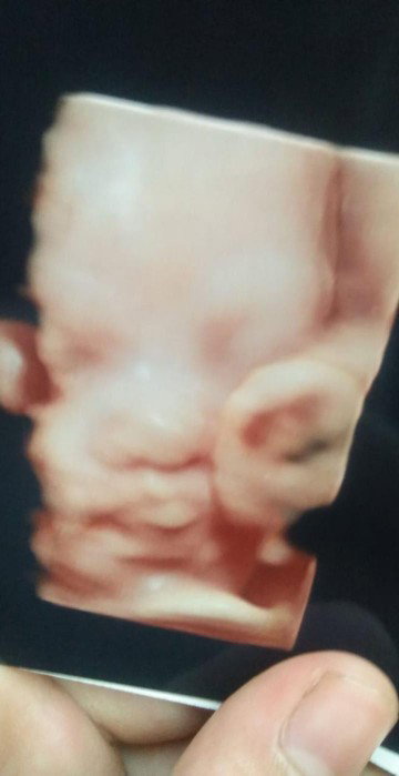 persiapan persalinan