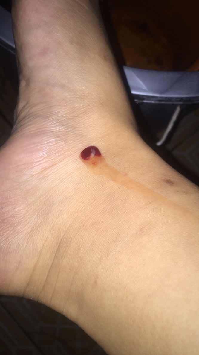 Keluar darah sedikit