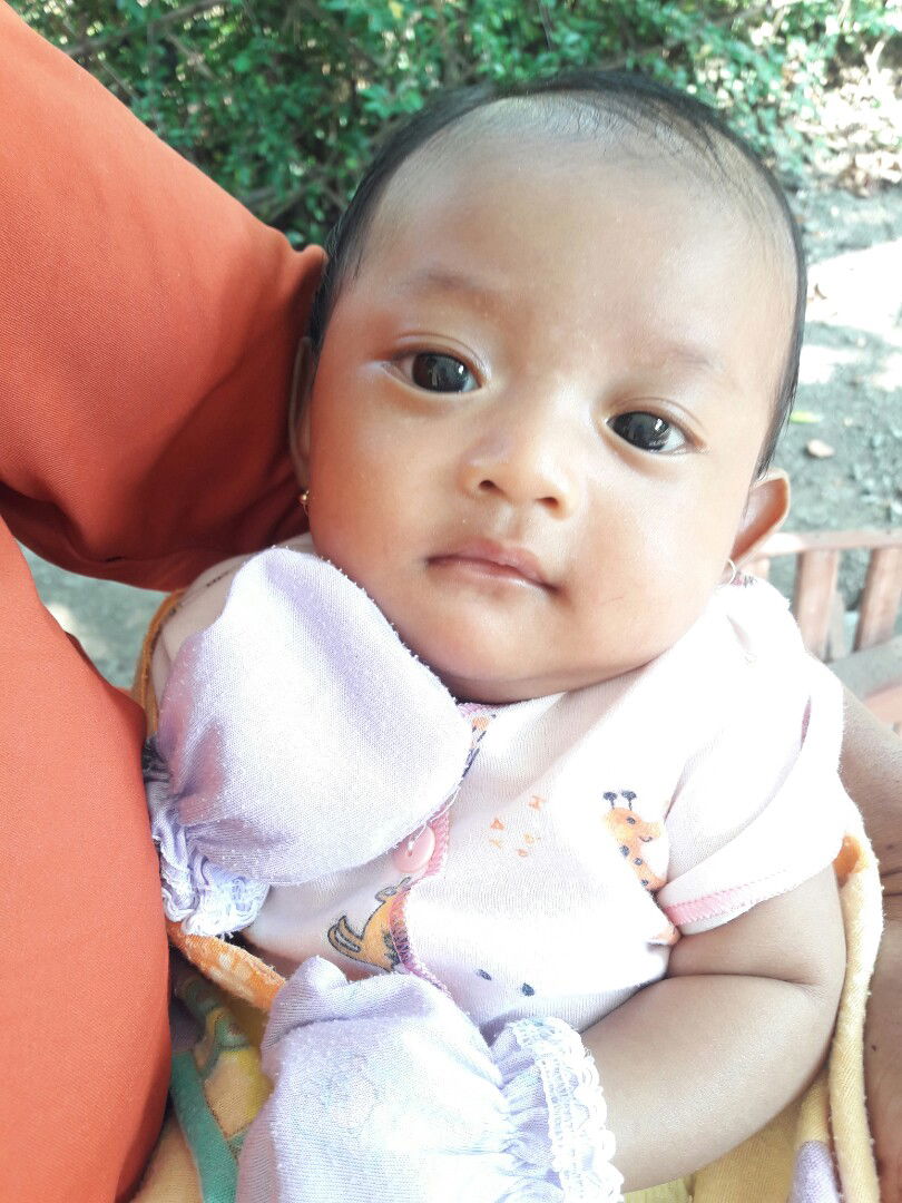 putih2 di tengah alis atas hidung