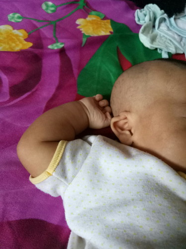 telinga bayi melipat ke dalam