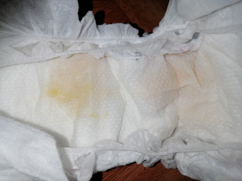 Baby Urine