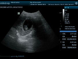 Seputar hamil 9 week