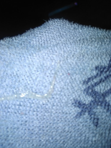 เป้นเหมือนตกขาวแต่ใสๆ