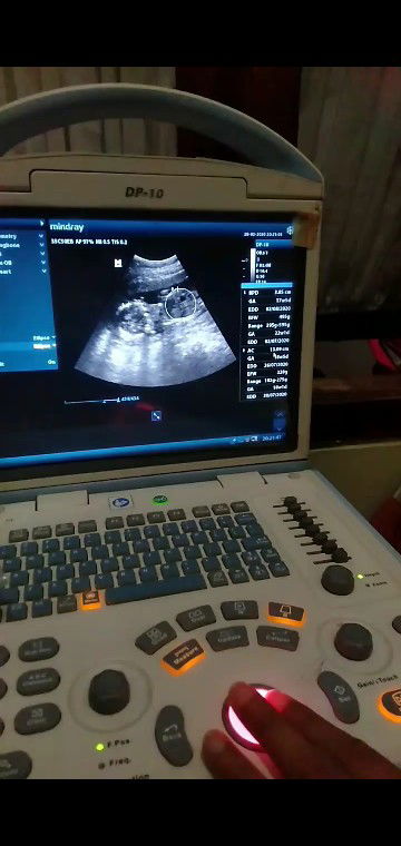 Mungkin Bu bidannya ngantuk ?