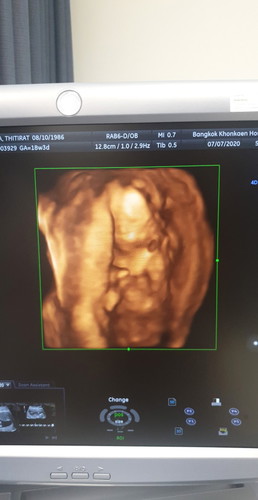 ดิ้นเก่ง