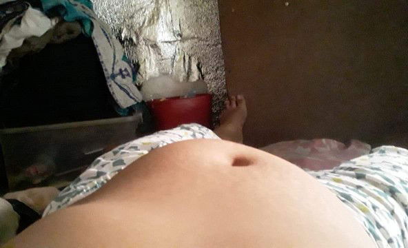 normal lng po ba yan??