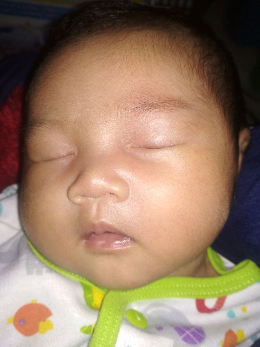 mata berair dan belekan