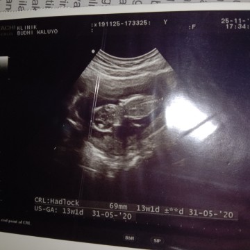 ini beratnya yg mana ya bun,,blm paham