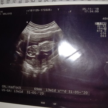 13week..