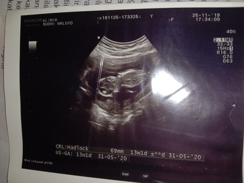 menurut bunda itu posisi dd gmn, wktu usg gk terlalu d jelasin,cuma d kasih tau panjangnya, liatin detak jantungnya, trus kata suster sehat, sama hpl nya,, klo kata asistennya bidan wktu aq anter mbah periksa, ktnya posisi miring, smua bgus cukup,, mf bun