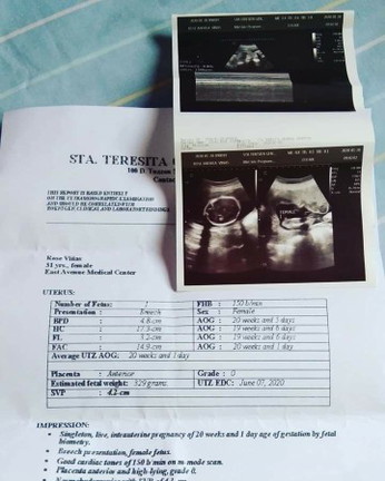 Gender Baby reveal???