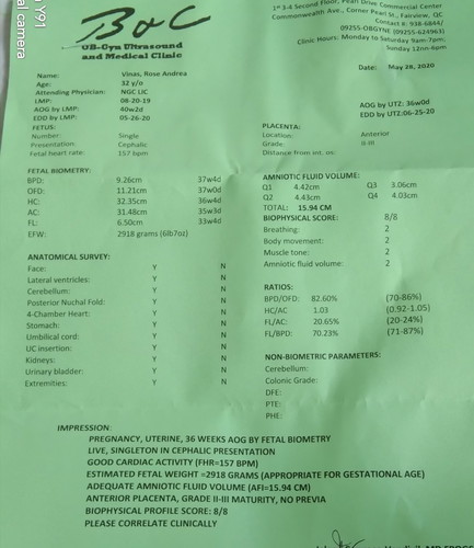BPS Result?