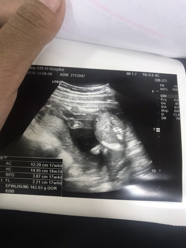 17+6weeks