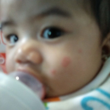 Ano po kaya ito sa mukha ni baby?
