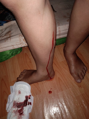 มีเลือดออกช่องคลอดอายุครรภ์ 12w6dค่ะ